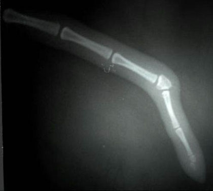 Рентгеновский снимок хвоста
