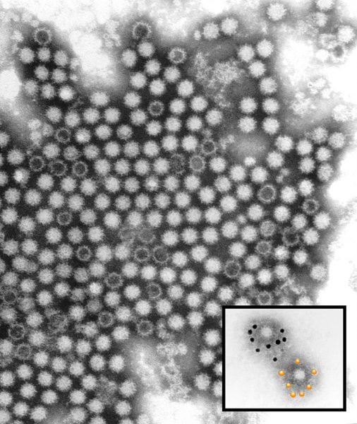 virus kalciviroza pod mikroskopom