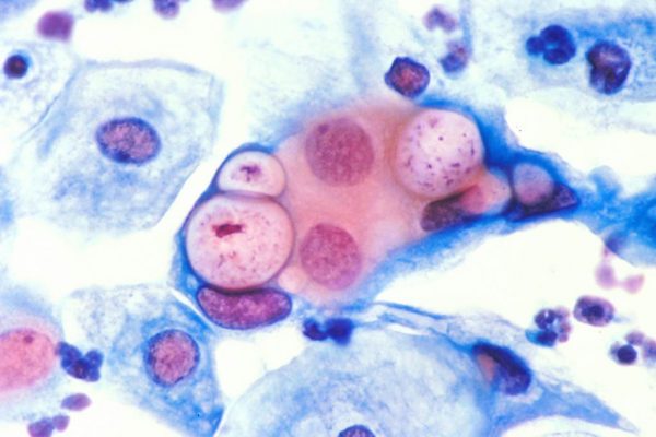 хламидия под микроскопом